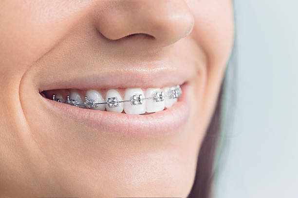 Laser Dentistry in Clearwater, FL